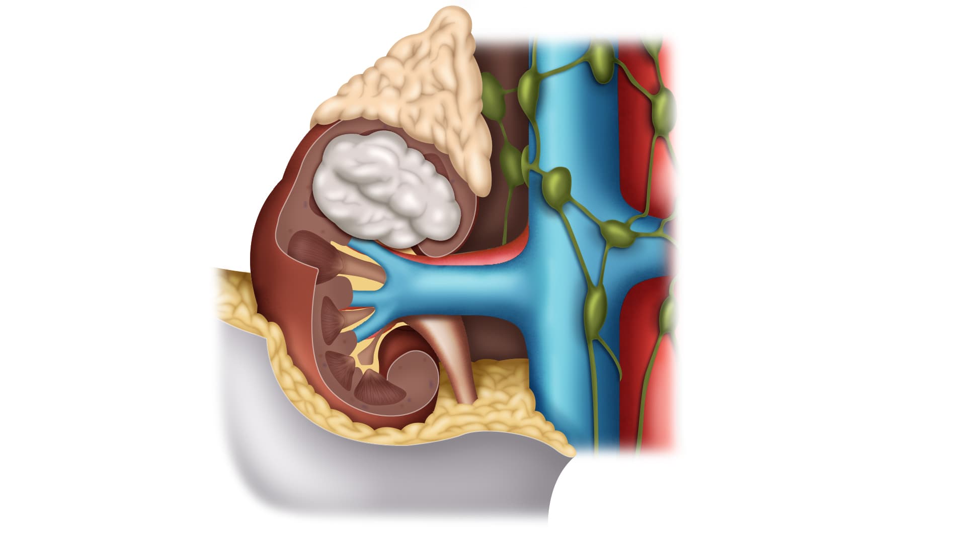 Kidney Dysfunction, Renal Failure 