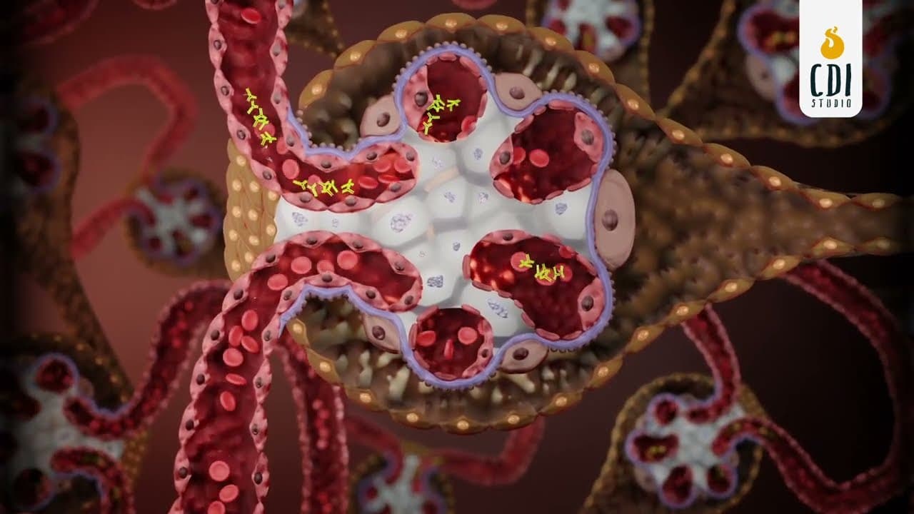 Antibody Deposition in Mesangial Cells