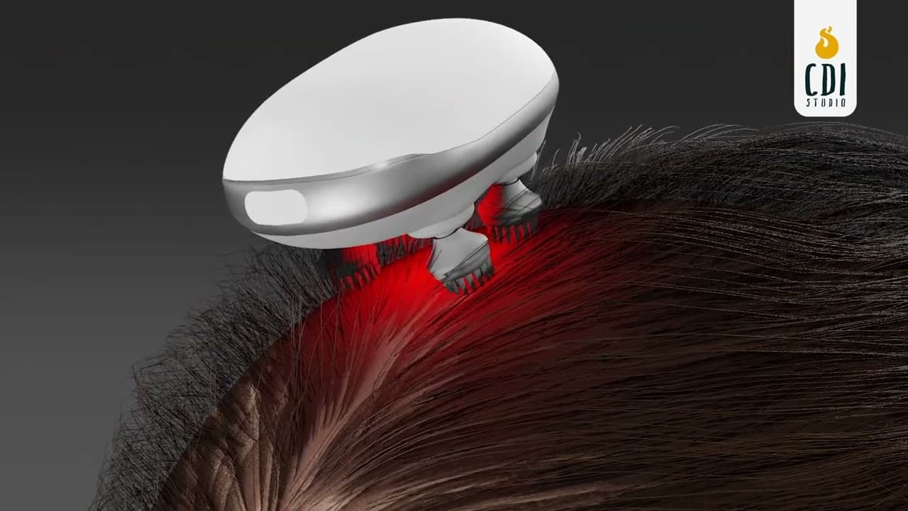 Showing how to prevent a Hair loss | 3D Medical Animation