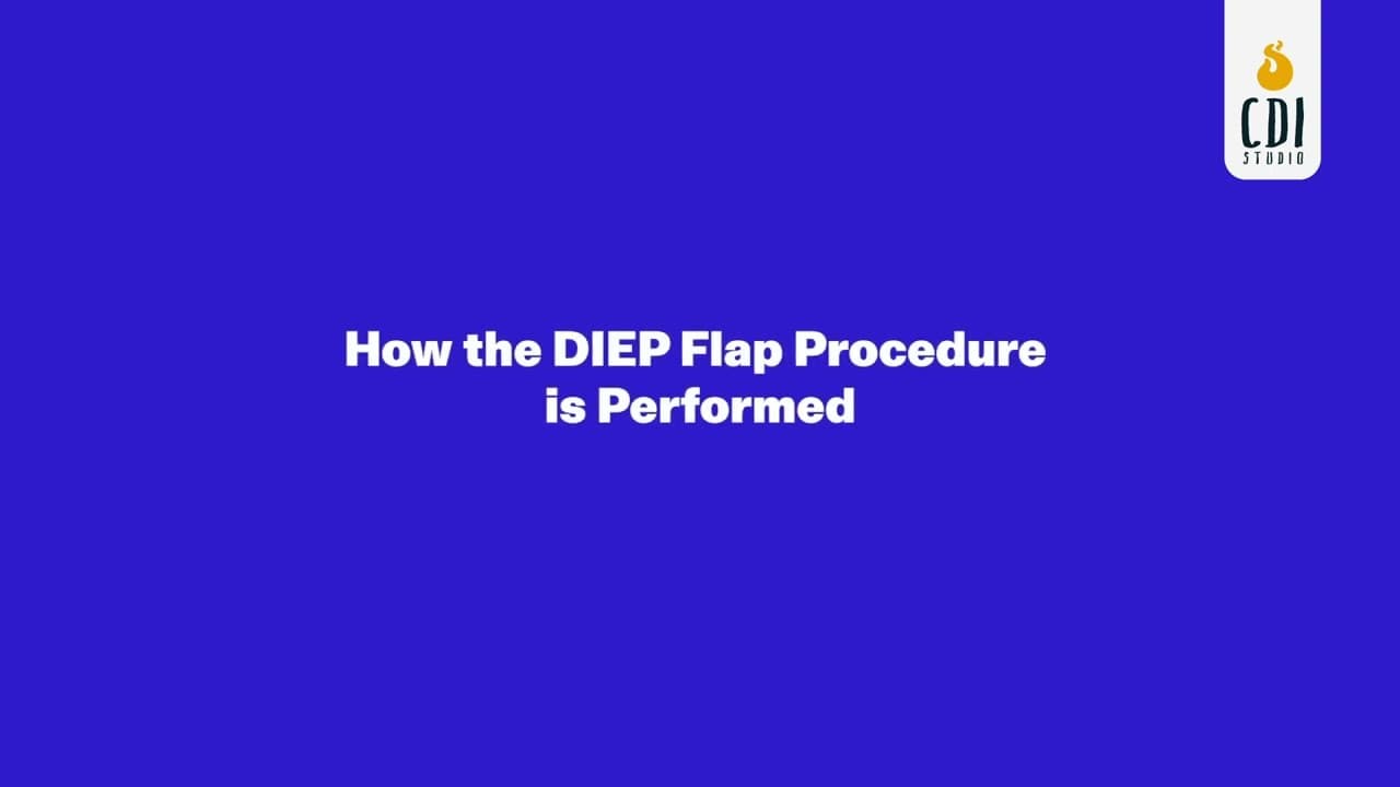  DIEP Flap Procedure | 3D Medical Animation