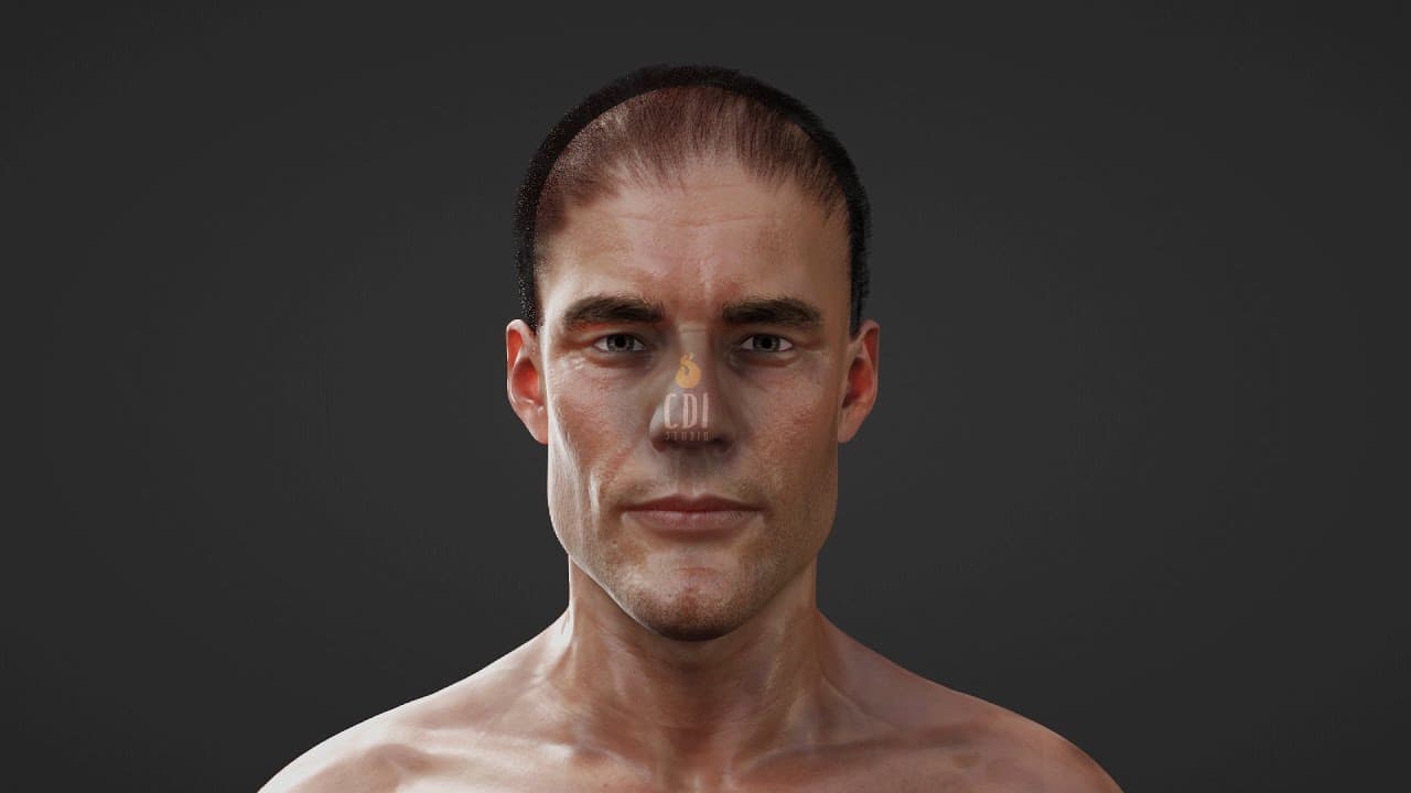  Hair loss in men via DHT | 3D Medical Animation