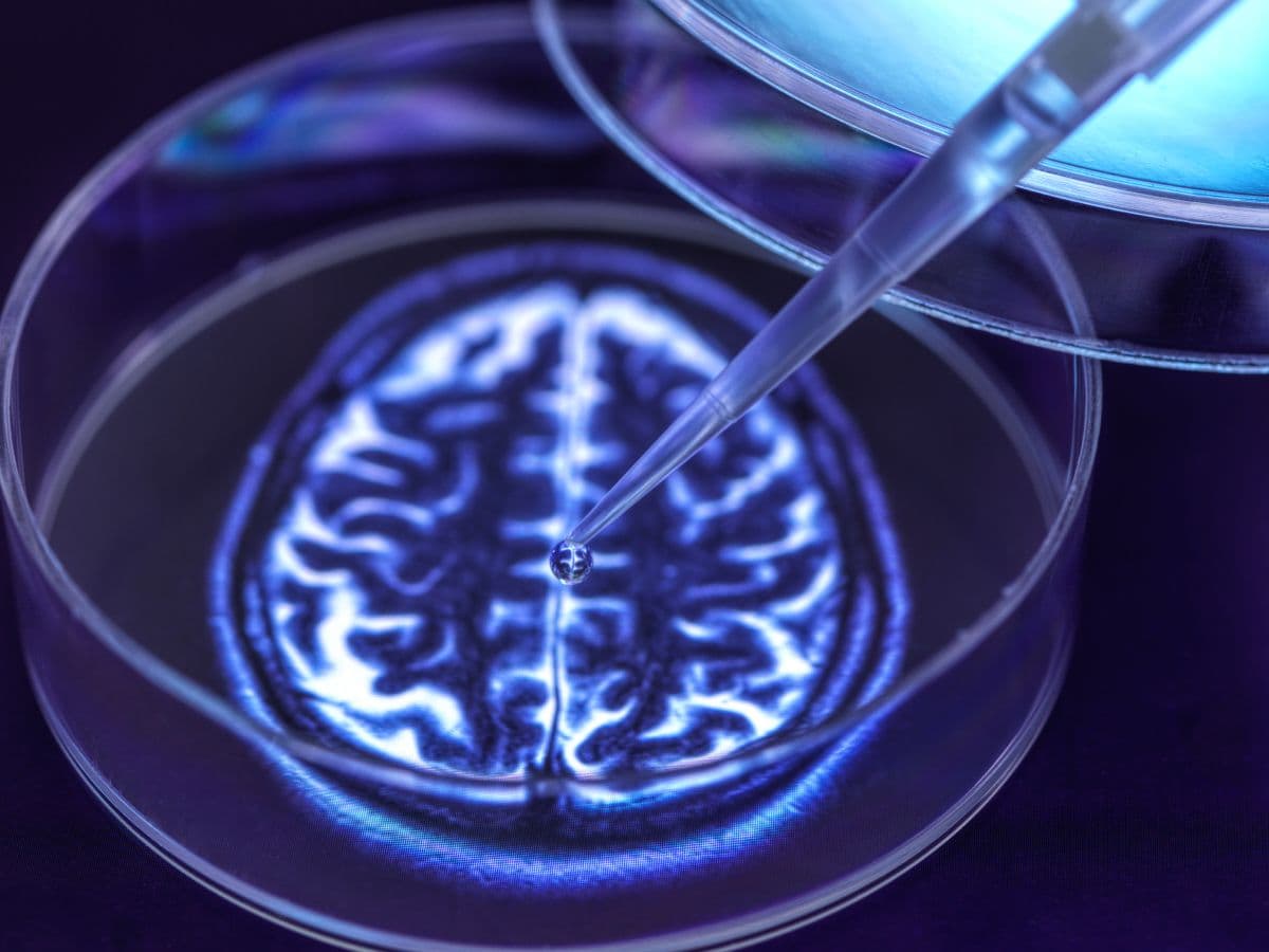 Brain organoids